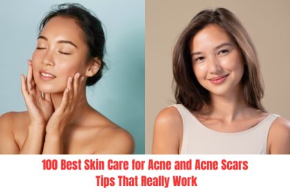 Discover 100 effective skin care for acne and acne scars tips that help clear breakouts, reduce inflammation, and restore smooth, healthy skin.