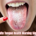 White tongue health warning signs can indicate dehydration, infection, poor hygiene, or underlying conditions—learn what your tongue is telling you.