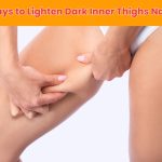 Struggling with pigmentation? Discover 10 proven ways to lighten dark inner thighs naturally using safe, effective home remedies and lifestyle changes.