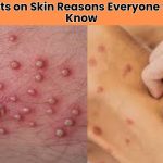 Wondering why red spots appear suddenly on your body? Here are 15 surprising red dots on skin reasons that may signal health issues or skin conditions.
