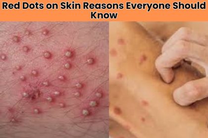 Wondering why red spots appear suddenly on your body? Here are 15 surprising red dots on skin reasons that may signal health issues or skin conditions.