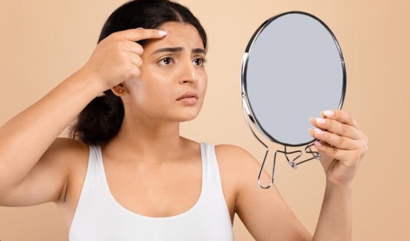 Why Your Skin Breaks Out When Stressed